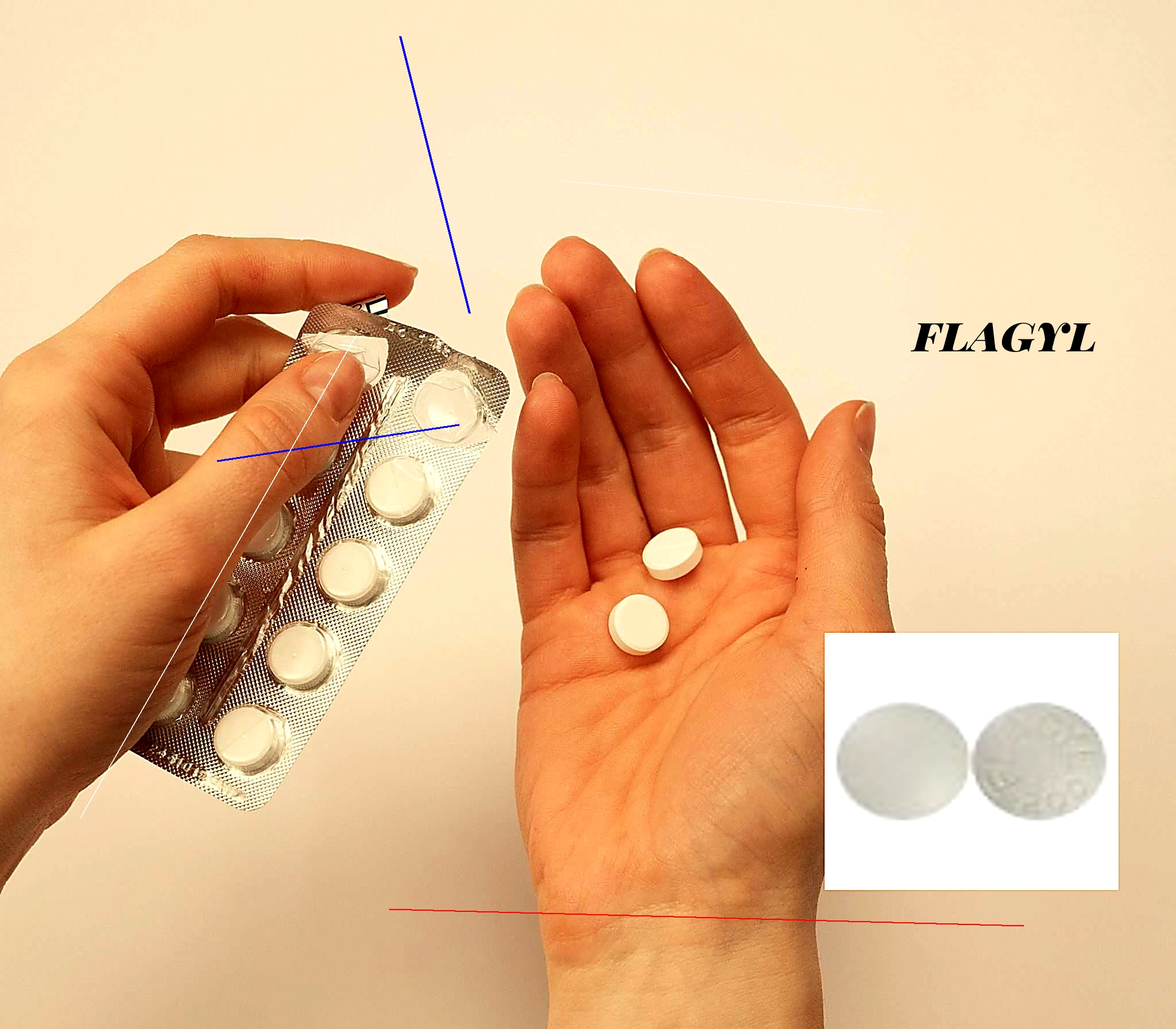 Flagyl sur ordonnance ou pas